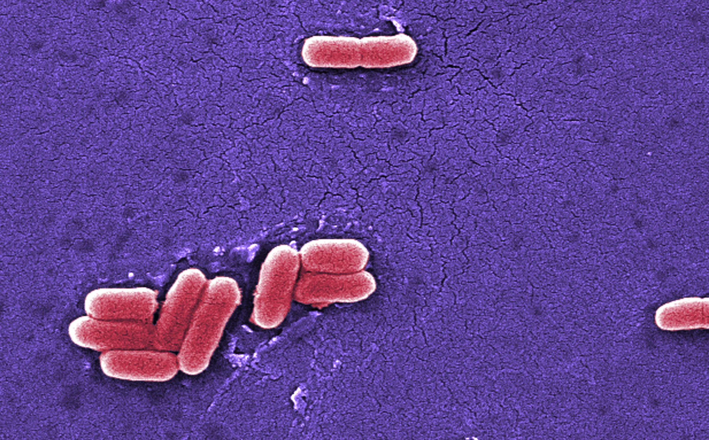 Raw Dairy Co. Denies Link to E. coli Outbreak